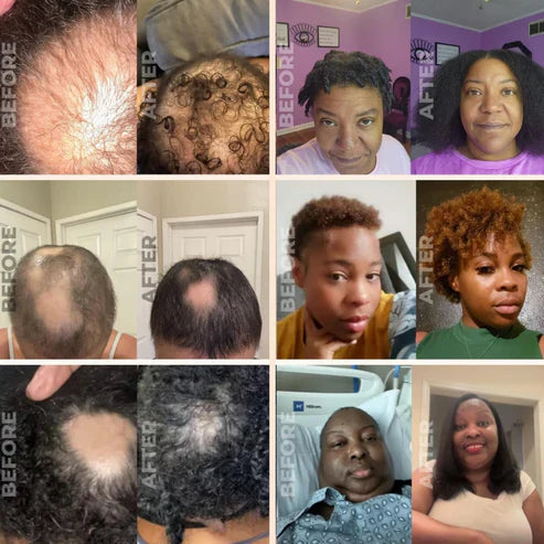 Huile de Croissance Naturelle pour Cheveux