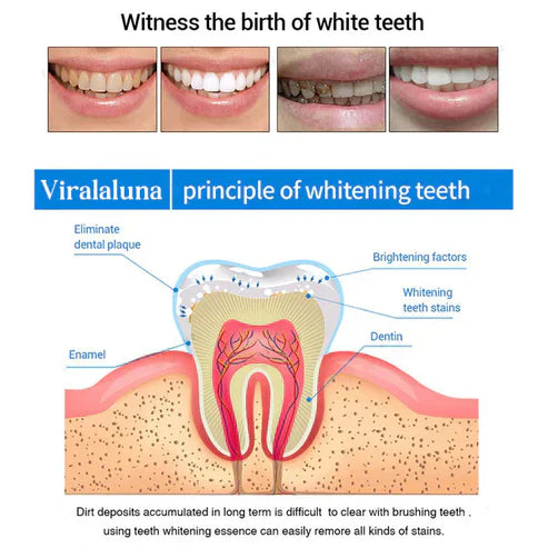 BUY 1 GET 1 FREE | Teeth Whitening Essence