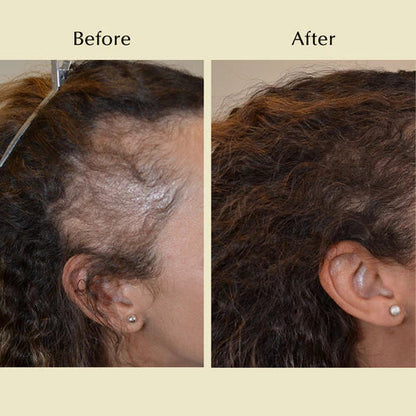 Natural Hair Growth Oil