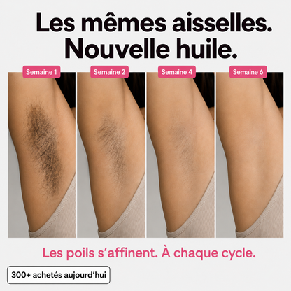 Huile anti-repousse des poils