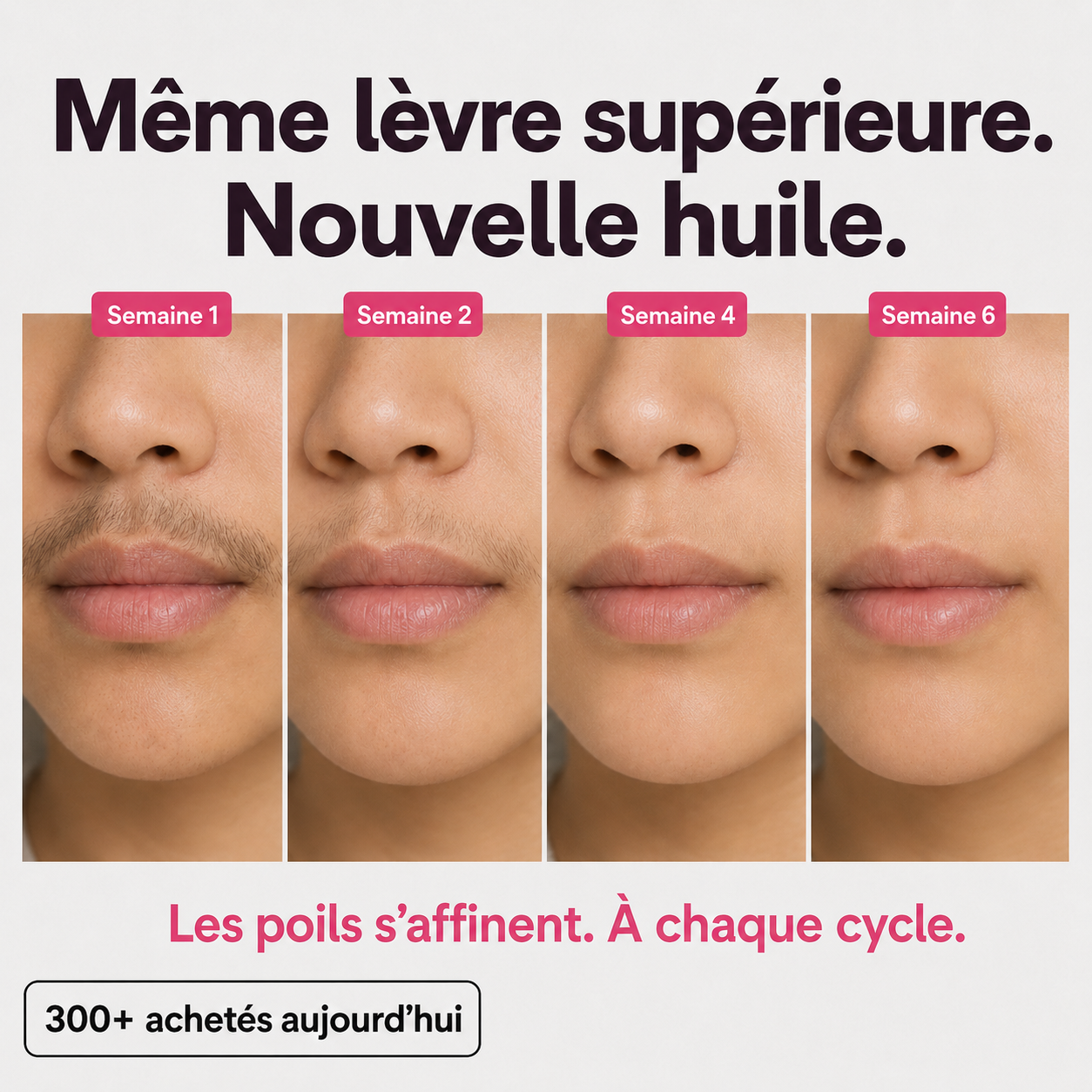 Huile anti-repousse des poils