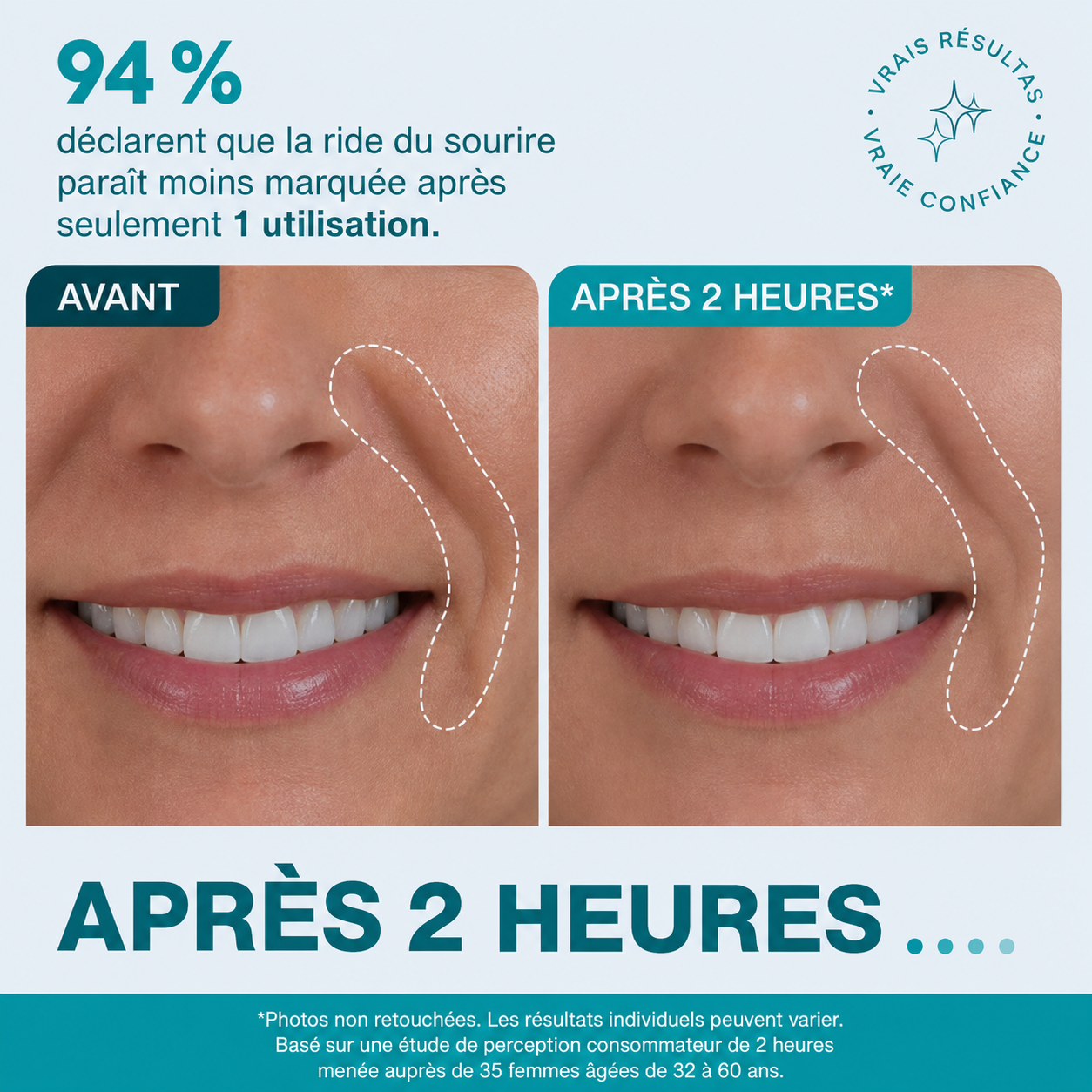 Bande visage et contour des yeux infusée aux peptides