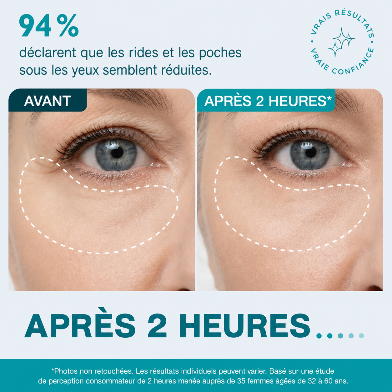 Bande visage et contour des yeux infusée aux peptides