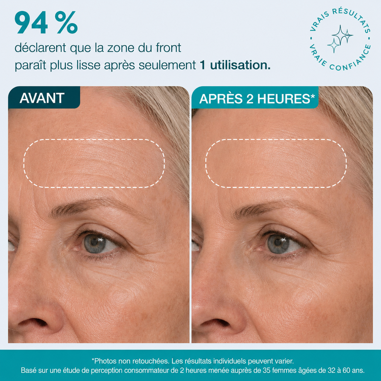 Bande visage et contour des yeux infusée aux peptides