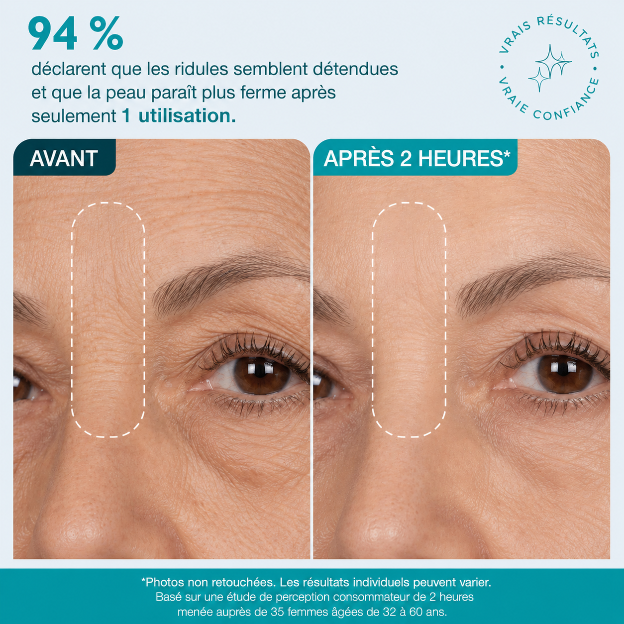 Bande visage et contour des yeux infusée aux peptides