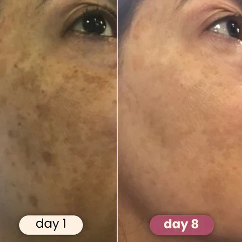 Brightening turmeric & kojic acid pads